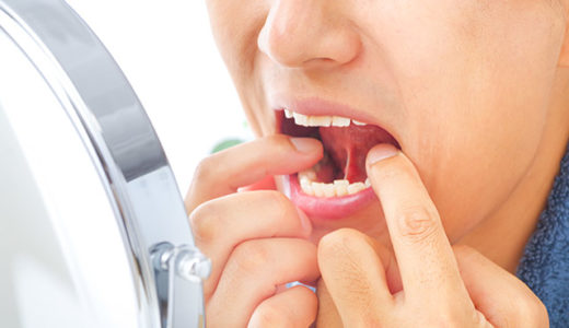 歯茎の腫れや痛みにおすすめの市販薬12選｜症状別に合わせてわかりやすく解説